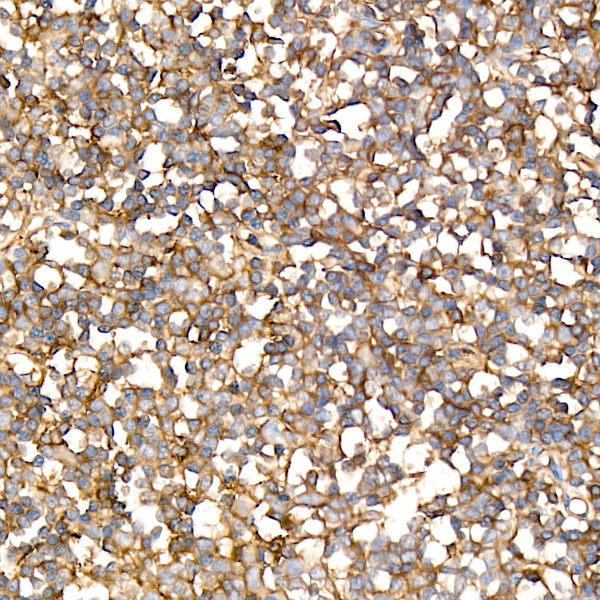CD200 Rabbit monoclonal antibody