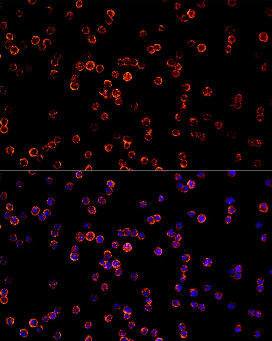 CD68 Rabbit monoclonal antibody
