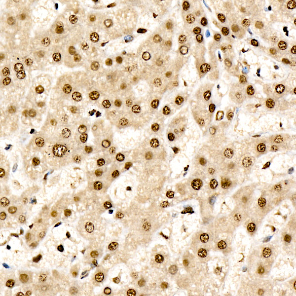 CHD4 Rabbit monoclonal antibody