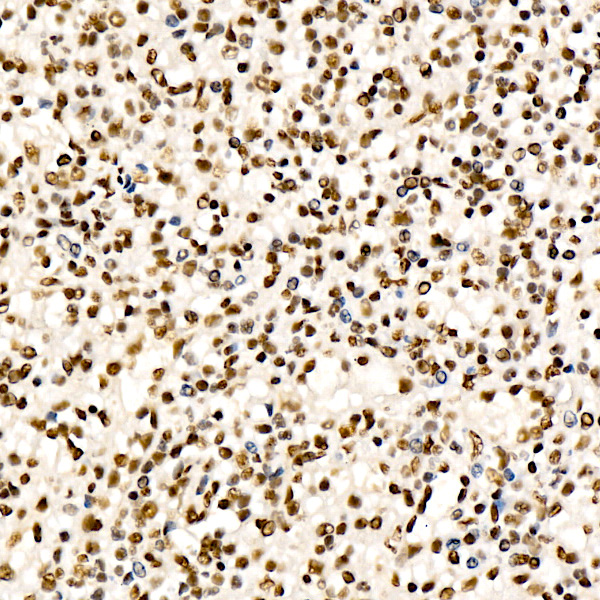 CHD4 Rabbit monoclonal antibody