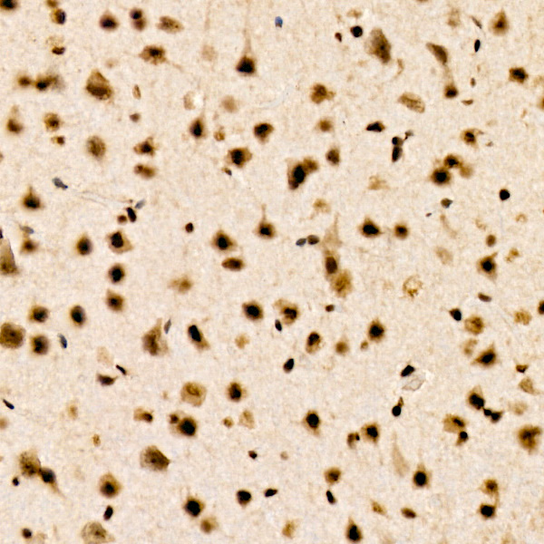 CHD4 Rabbit monoclonal antibody