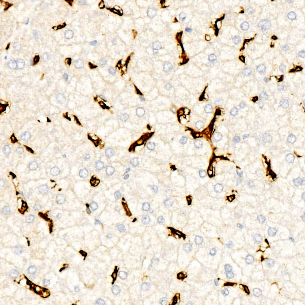 CD16 Rabbit monoclonal antibody