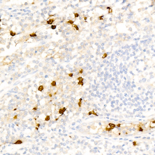 CD16 Rabbit monoclonal antibody