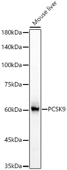 PCSK9 Rabbit polyclonal antibody