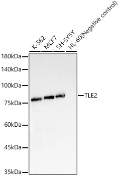 TLE2 Rabbit monoclonal antibody