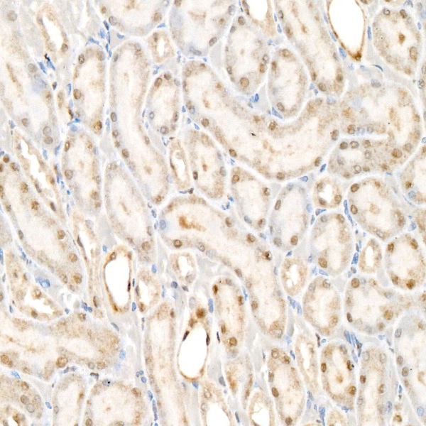 TLE2 Rabbit monoclonal antibody