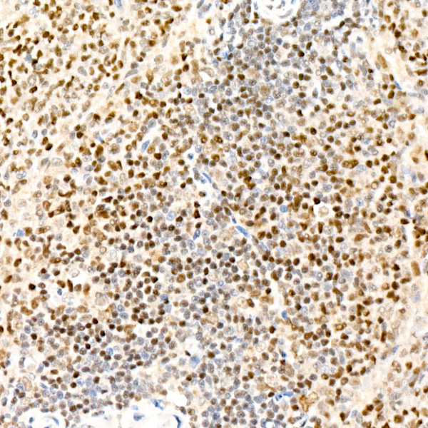 TLE2 Rabbit monoclonal antibody