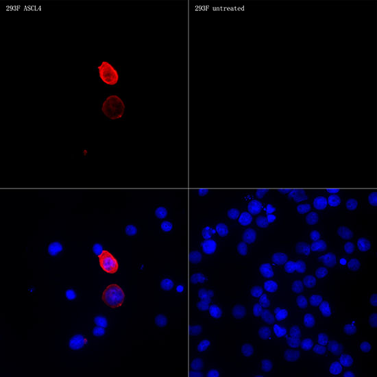 ASCL4 Rabbit monoclonal antibody