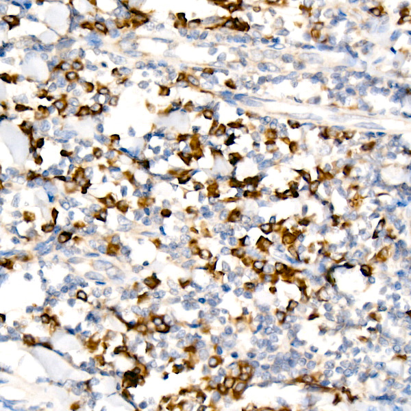WNK3 Rabbit monoclonal antibody