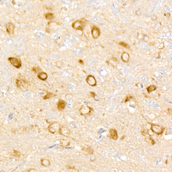 WNK3 Rabbit monoclonal antibody