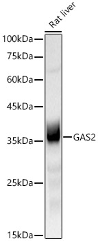 GAS2 Rabbit monoclonal antibody