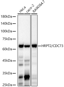 HRPT2 / CDC73 Rabbit monoclonal antibody