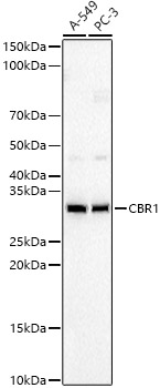 CBR1 Rabbit monoclonal antibody