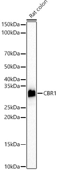 CBR1 Rabbit monoclonal antibody