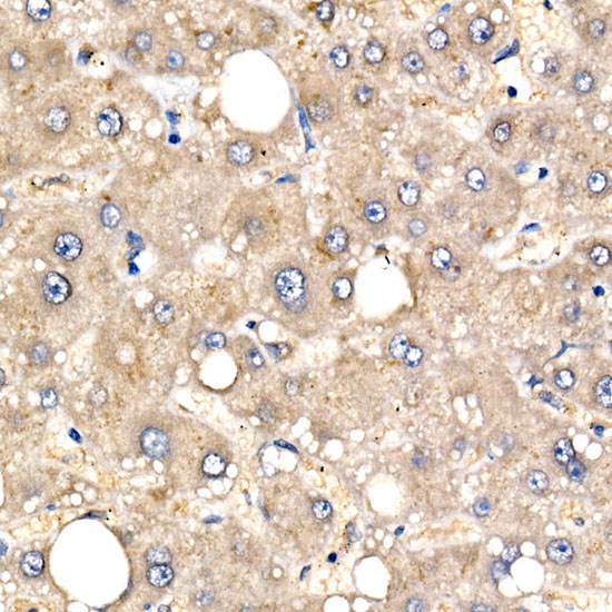 CBR1 Rabbit monoclonal antibody