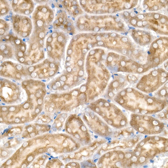 CBR1 Rabbit monoclonal antibody