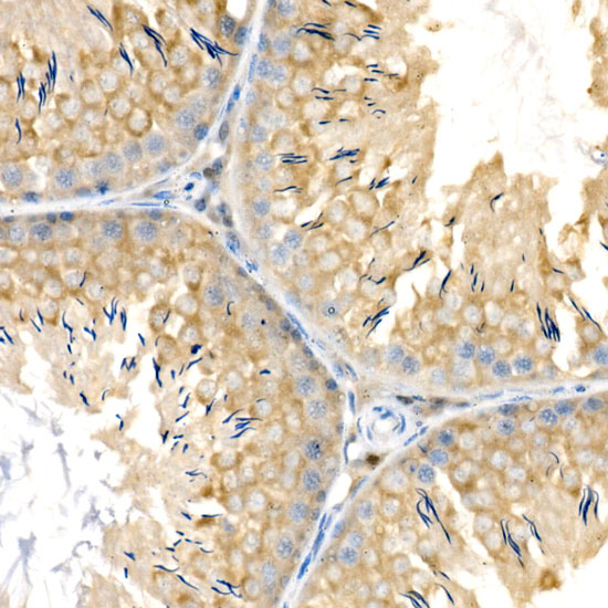 CBR1 Rabbit monoclonal antibody