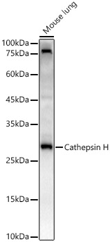 Cathepsin H Rabbit monoclonal antibody