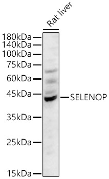 SELENOP Rabbit polyclonal antibody