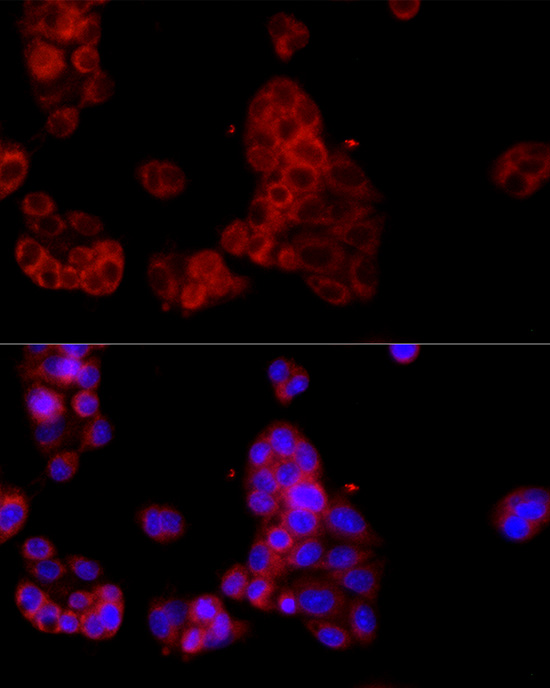 SELENOP Rabbit polyclonal antibody