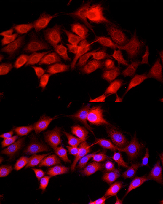 SELENOP Rabbit polyclonal antibody