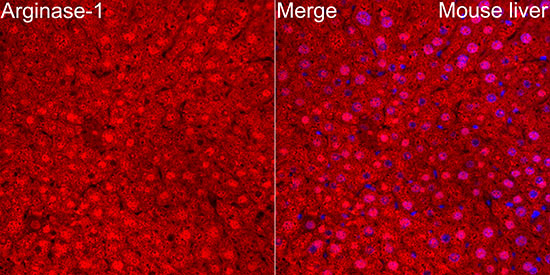 Arginase-1 Rabbit polyclonal antibody