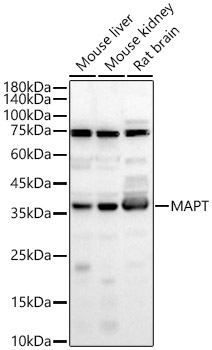 MAPT Rabbit polyclonal antibody