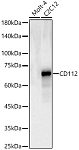 Western blot - CD112 Rabbit pAb (A23657)