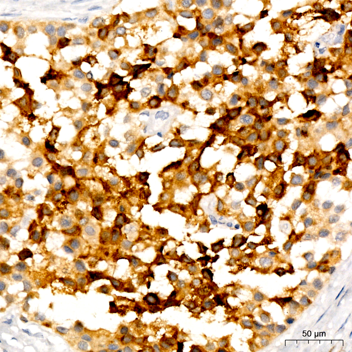 PMEL Rabbit monoclonal antibody