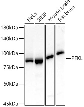 PFKL Rabbit monoclonal antibody