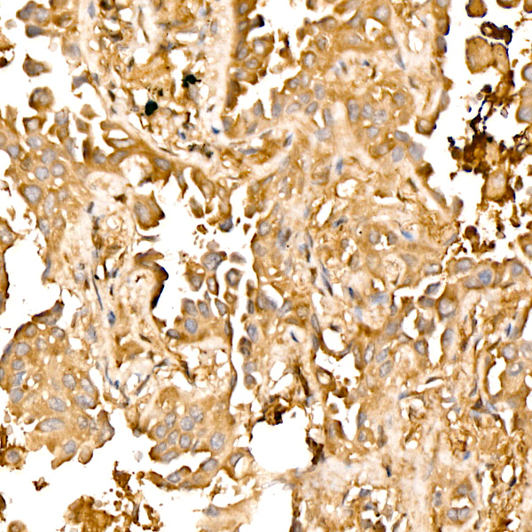 PFKL Rabbit monoclonal antibody