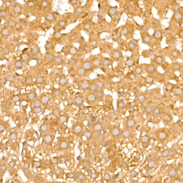 PFKL Rabbit monoclonal antibody