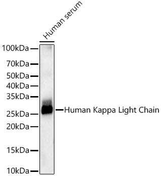 Human Kappa Light Chain Rabbit monoclonal antibody