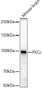 PKCE Epsilon Rabbit monoclonal antibody