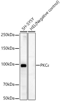 PKCE Epsilon Rabbit monoclonal antibody