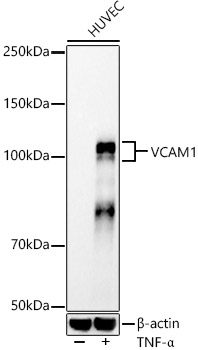 VCAM1 Rabbit monoclonal antibody