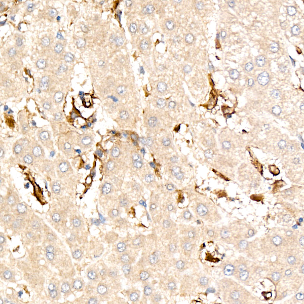 VCAM1 Rabbit monoclonal antibody