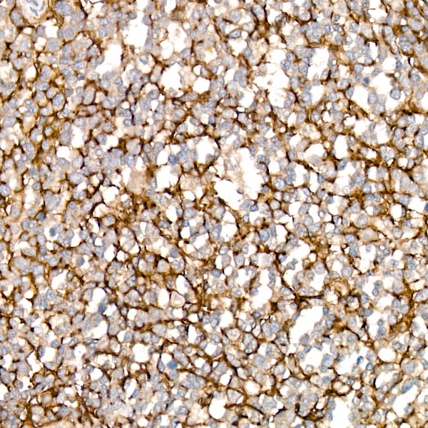VCAM1 Rabbit monoclonal antibody