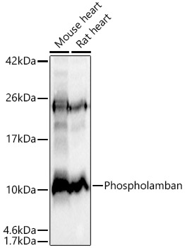 Phospholamban Rabbit monoclonal antibody
