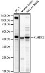 Western blot - KLHDC2 Rabbit mAb (A23751)