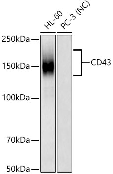 CD43 Rabbit monoclonal antibody