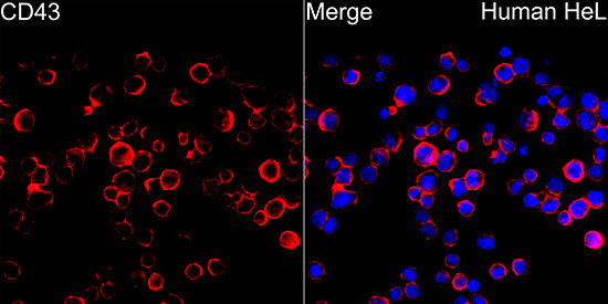 CD43 Rabbit monoclonal antibody