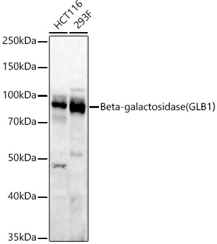 Beta-galactosidase (GLB1) Rabbit monoclonal antibody