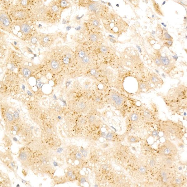 Beta-galactosidase (GLB1) Rabbit monoclonal antibody