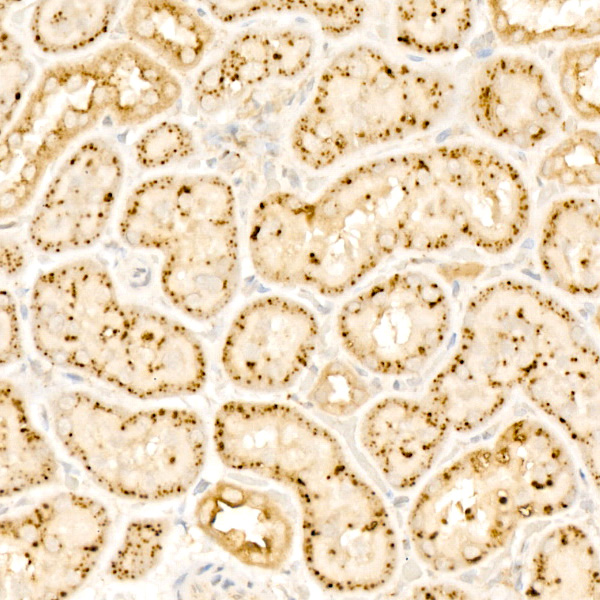 Beta-galactosidase (GLB1) Rabbit monoclonal antibody