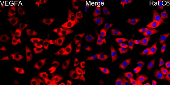 VEGF Rabbit monoclonal antibody