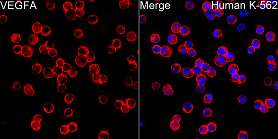 VEGF Rabbit monoclonal antibody