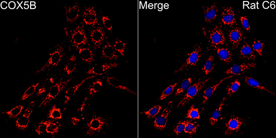 COX5B Rabbit monoclonal antibody