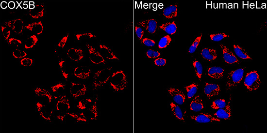 COX5B Rabbit monoclonal antibody