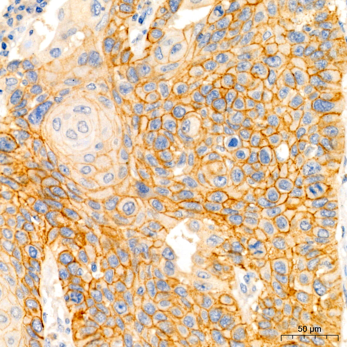 EGFR Rabbit monoclonal antibody